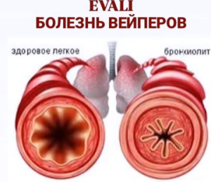 Вейпинг – вред модной электроники